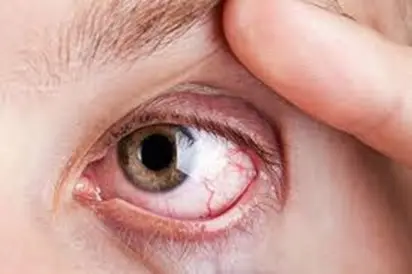 Diabetic Retinopathy: Understanding Its Stages and Treatment Options